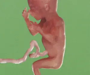 Dogpiss